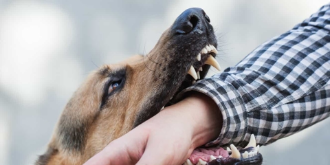 Dog biting a man's arm